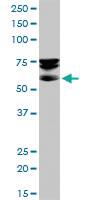 Anti-SEPT9 Mouse Polyclonal Antibody