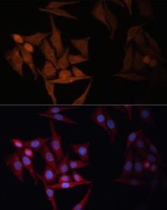 Immunofluorescence analysis of HeLa cells using Anti-MHC Class II beta Antibody (A306106) at a dilution of 1:100. DAPI was used to stain the cell nuclei (blue)