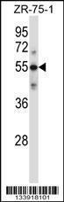 Anti-C9 Rabbit Polyclonal Antibody (HRP (Horseradish Peroxidase))