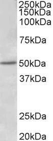 Anti-ESR2 Antibody (A83108) (1 µg/ml) staining of Human Placenta lysate (35 µg protein in RIPA buffer). Primary incubation was 1 hour. Detected by chemilu minescence