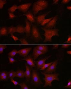 Immunofluorescence analysis of A-549 cells using Anti-BMPR1B Antibody (A309037) at a dilution of 1:200 (40x lens). DAPI was used to stain the cell nuclei (blue).