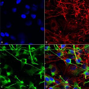 Anti-NMDAR2A antibody