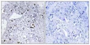 Anti-CBX5 antibody