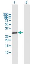 Anti-HOXB1 Rabbit Polyclonal Antibody