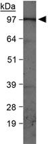 Anti-PIK3C3 Rabbit Polyclonal Antibody