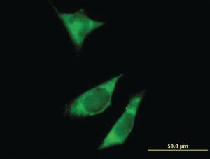 Anti-RPTOR Mouse Polyclonal Antibody