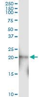 Anti-N6AMT1 Rabbit Polyclonal Antibody