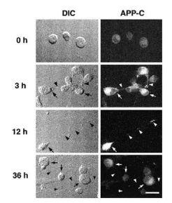 Anti-Amyloid precursor protein antibody