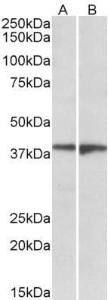 Anti-S1PR5 antibody