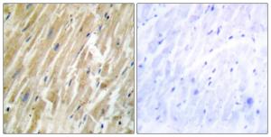 Immunohistochemical analysis of paraffin-embedded human heart tissue using Anti-CALR Antibody The right hand panel represents a negative control, where the antibody was pre-incubated with the immunising peptide