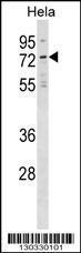 Anti-NET1 Rabbit Polyclonal Antibody (APC (Allophycocyanin))