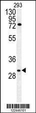 Anti-CLDN12 Rabbit Polyclonal Antibody (HRP (Horseradish Peroxidase))