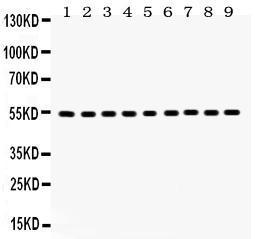 Anti-VIM Rabbit Polyclonal Antibody