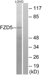 Western blot analysis of lysates from LOVO cells using Anti-FZD5 Antibody. The right hand lane represents a negative control, where the antibody is blocked by the immunising peptide