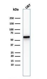 Western blot analysis of U87 cell lysate using Anti-p75 NGF Receptor Antibody [NGFR/2550R]