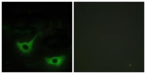 Immunofluorescence analysis of NIH/3T3 cells using Anti-CALR Antibody The right hand panel represents a negative control, where the antibody was pre-incubated with the immunising peptide