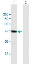 Anti-EIF2D Mouse Polyclonal Antibody