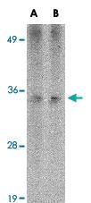 Anti-HAX1 Mouse Monoclonal Antibody [clone: 9G6C6]