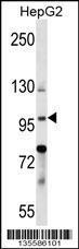 Anti-BNC1 Rabbit Polyclonal Antibody