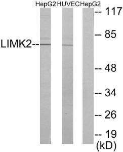 Western blot analysis of lysates from HepG2 and HUVEC cells using Anti-LIMK2 Antibody. The right hand lane represents a negative control, where the antibody is blocked by the immunising peptide