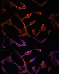 Immunofluorescence analysis of NIH/3T3 cells using Anti-MHC Class II beta Antibody (A306106) at a dilution of 1:100. DAPI was used to stain the cell nuclei (blue)