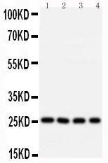 Anti-Bcl10 Rabbit Polyclonal Antibody