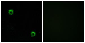 Immunofluorescence analysis of MCF7 cells using Anti-FZD2 Antibody. The right hand panel represents a negative control, where the antibody was pre-incubated with the immunising peptide.