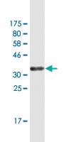 Anti-GLIPR1 Mouse Monoclonal Antibody [clone: 8D9]