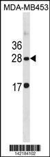 Anti-CLDN14 Rabbit Polyclonal Antibody (APC (Allophycocyanin))