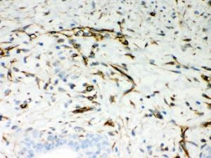 Anti-VIM Rabbit Polyclonal Antibody