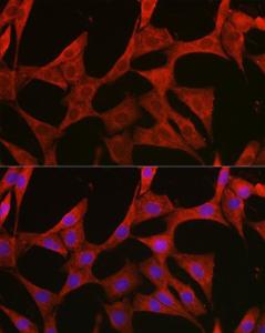 Immunofluorescence analysis of NIH/3T3 cells using Anti-BMPR1B Antibody (A309037) at a dilution of 1:200 (40x lens). DAPI was used to stain the cell nuclei (blue).