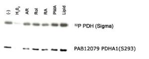 Anti-PDHA1 Rabbit Polyclonal Antibody