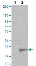 Anti-MMGT1 Rabbit Polyclonal Antibody