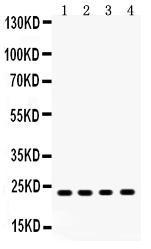 Anti-RBP4 Rabbit Polyclonal Antibody