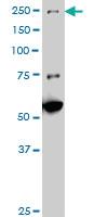 Anti-MAP3K4 Mouse Monoclonal Antibody [clone: X1]