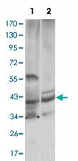 Anti-CST3 Mouse Monoclonal Antibody [clone: 5H2]