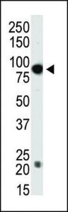 Anti-DNMT3B Rabbit Polyclonal Antibody (FITC (Fluorescein Isothiocyanate))