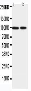 Anti-EPB41L1 Rabbit Antibody