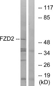 Western blot analysis of lysates from HeLa cells using Anti-FZD2 Antibody. The right hand lane represents a negative control, where the antibody is blocked by the immunising peptide.