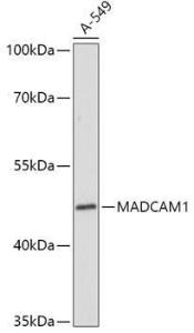 Anti-MAdCAM1 antibody