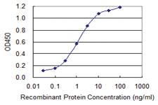 Anti-SEPT9 Mouse Monoclonal Antibody [clone: 2C6]