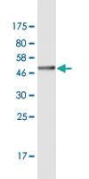 Anti-ASH1L Mouse Monoclonal Antibody [clone: 4G12]