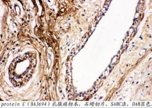 Anti-Protein C Rabbit Polyclonal Antibody