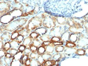 Immunohistochemical analysis of formalin-fixed, paraffin-embedded human renal cell carcinoma using Anti-Mitochondria Antibody [MTC754]