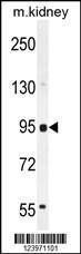 Anti-MME Rabbit Polyclonal Antibody (AP (Alkaline Phosphatase))