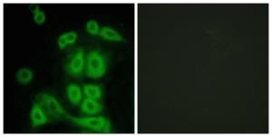 Immunofluorescence analysis of A549 cells using Anti-FXR2 Antibody. The right hand panel represents a negative control, where the antibody was pre-incubated with the immunising peptide.