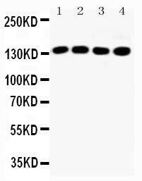 Anti-IRS1 Rabbit Antibody