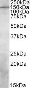 Anti-PREX1 Antibody (A84704) (1 µg/ml) staining of Human Temporal Cortex lysate (35 µg protein in RIPA buffer). Primary incubation was 1 hour. Detected by chemiluminescence