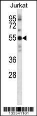 Anti-NETO2 Rabbit Polyclonal Antibody (AP (Alkaline Phosphatase))