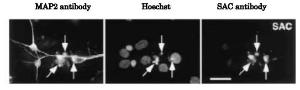 Anti-APP delta C31 Antibody